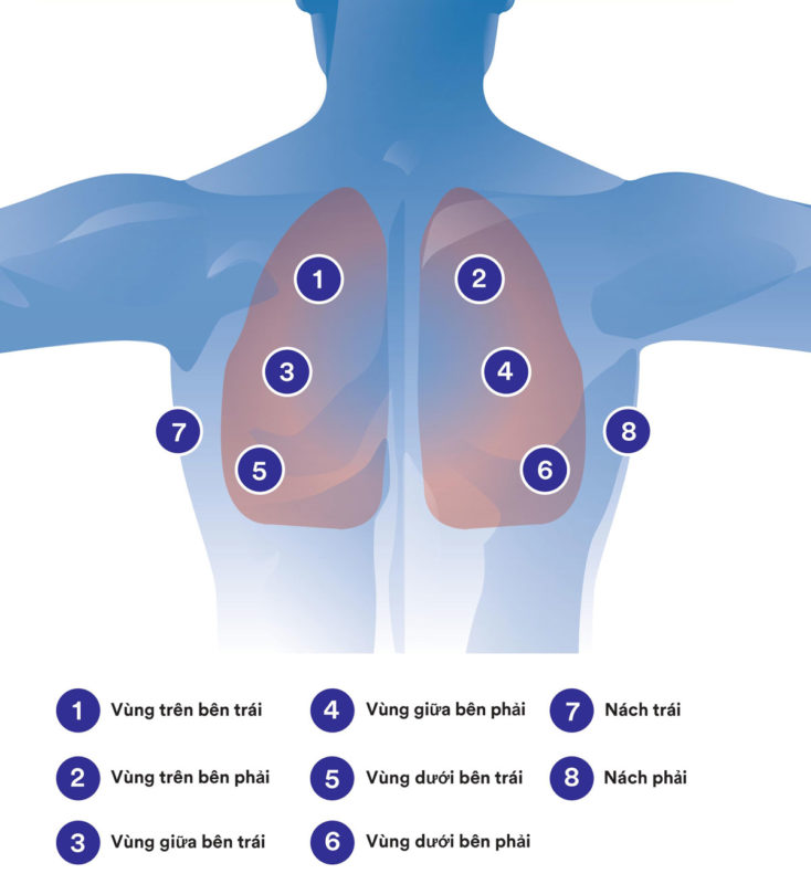 Những vị trí nghe âm phổi phổ biến